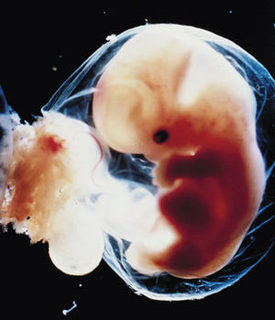 A human fetus at approximately 6 weeks post-conception.