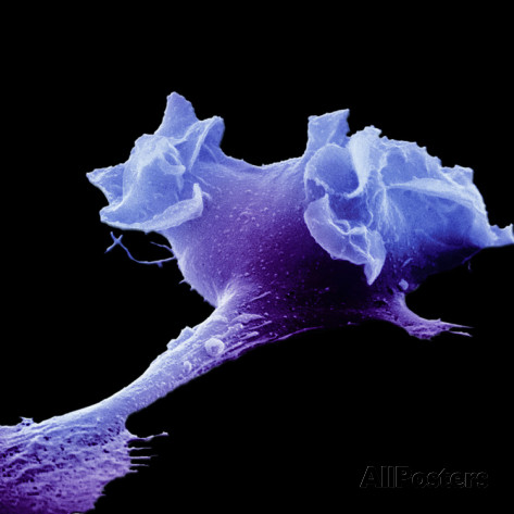 A macrophage extends a "foot" out into space to "test the waters" before moving its entire body to the new position.