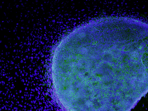 A colony of embryonic stem cells derived from donated human tissue (blue and green), growing on a layer of fibroblasts (blue). (Photo credit: CIRM/Flickr)
